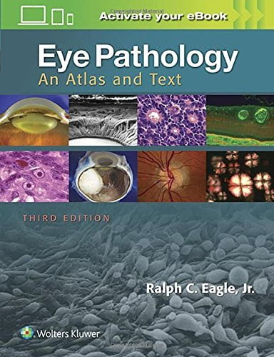 Eye pathology : an atlas and text